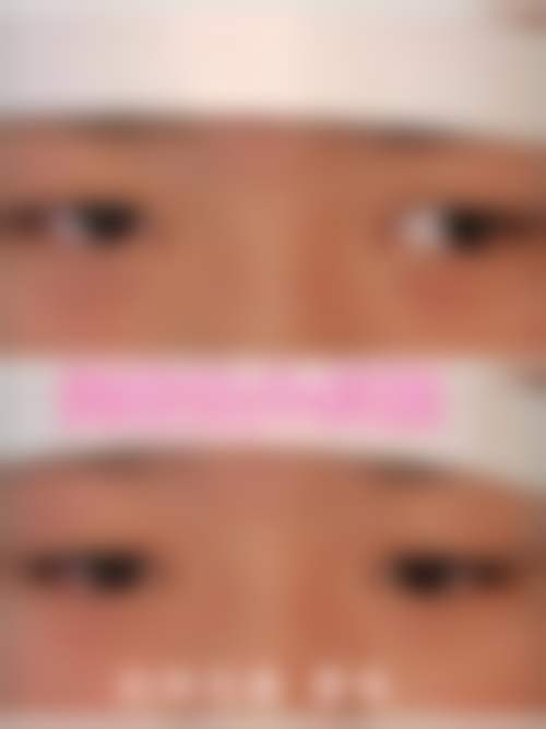 西安市高陵区医院眼科