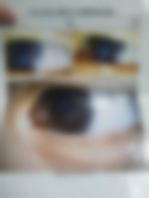 擅长项目详解:廖志强医生擅长的近视手术适合我吗?