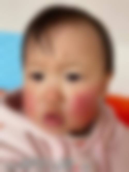 擅长项目详解:精细匹配您的眼部需求