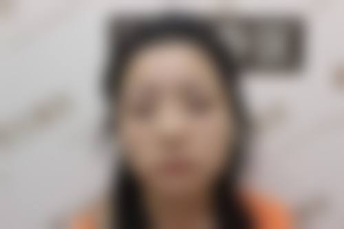 临床实例分享