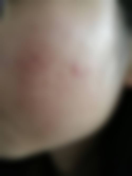 擅长项目详解