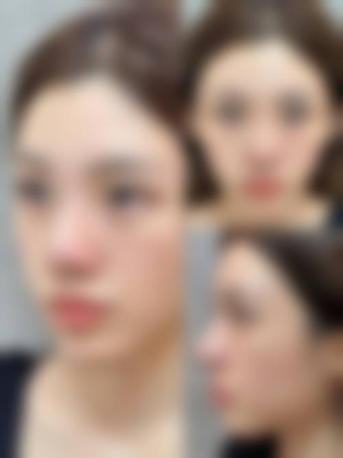 临床实例分享:张金医生能达到理想成效吗?