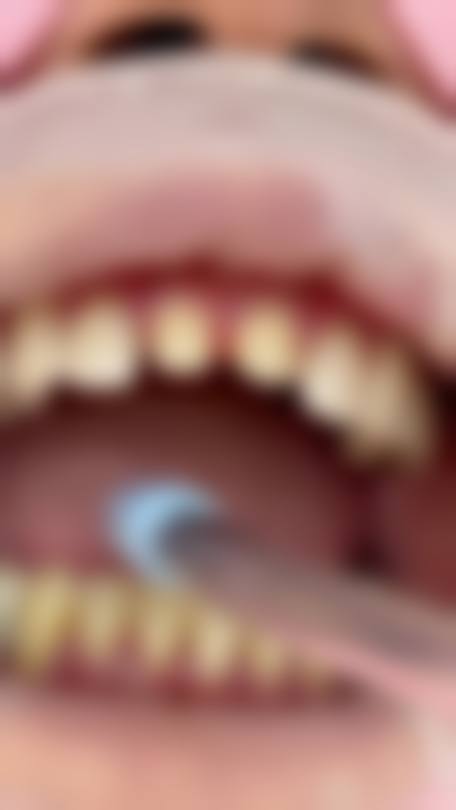 患者真实评价:南昌德亚口腔门诊部姜奉孝医生评价好吗?