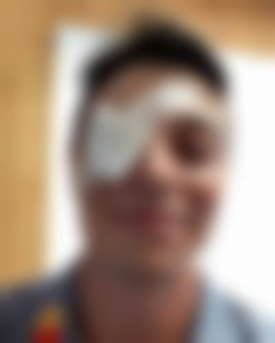临床实例分享:找廖志强医生做手术,成效有保护吗?