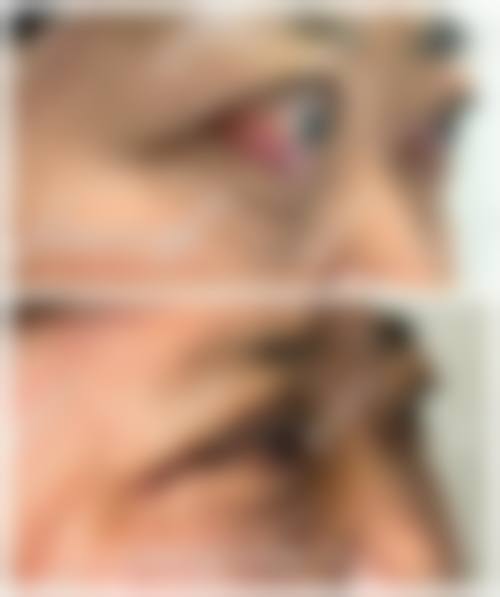 诊疗特色总结:为什么推荐成都市第三人民医院眼科?