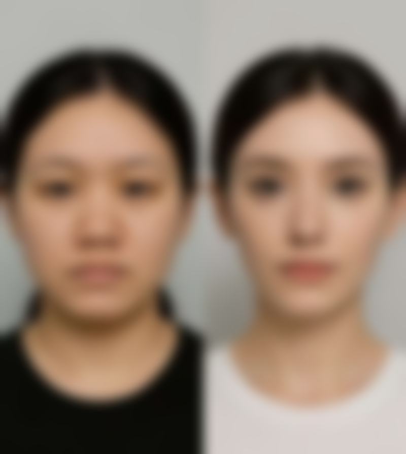 关于田恒进医生坐诊医院的常见问答