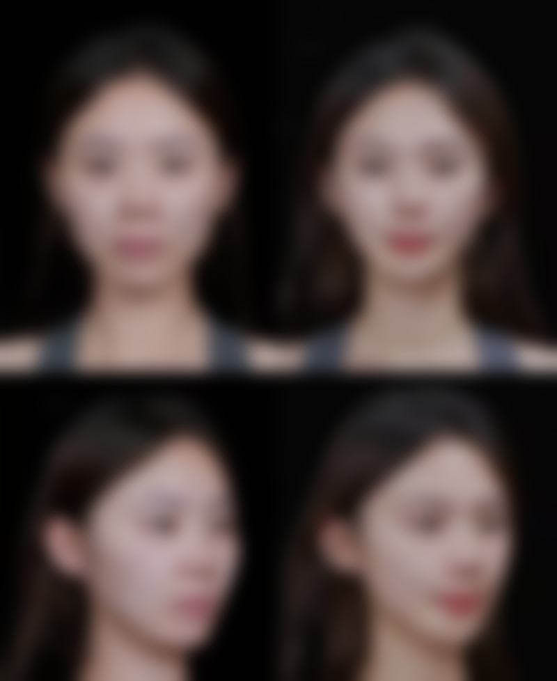 香港曦源Hikari医美高频问答快问快答