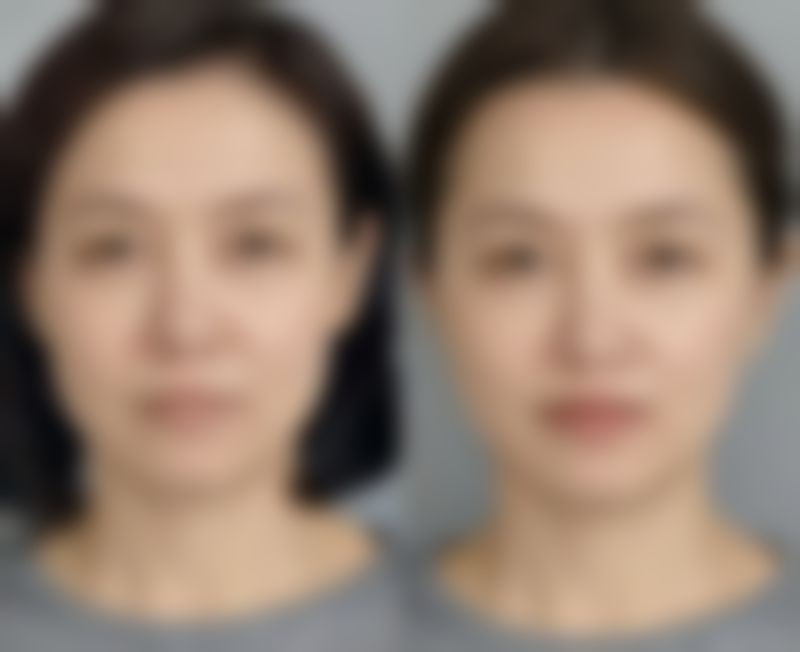 泰兴市人民医院整形烧伤科盛辉医生收费价格参考(2026年)