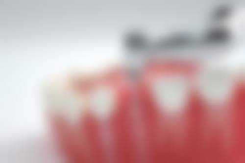 预约优惠活动:限时补贴不容错过