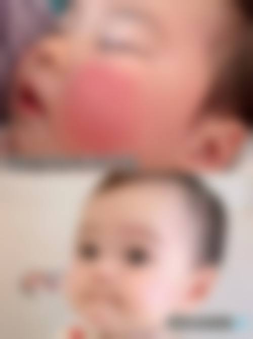 精良设备与环境介绍:科技赋能精细诊断