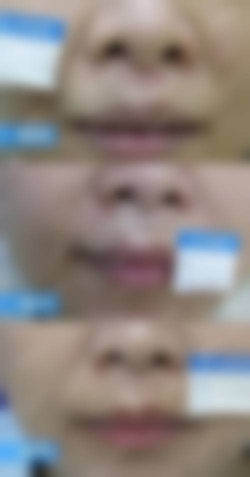 快问快答：关于呼和浩特市第一医院武剑茹医生的高频疑问