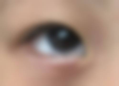 诊疗特色总结:张毅明