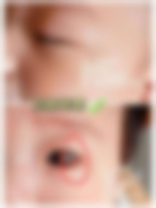临床实例分享:治疗成效真实可靠吗?