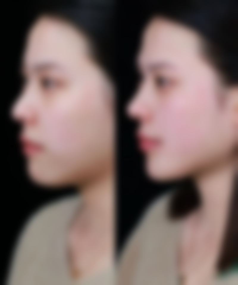 呼和浩特市第一医院医疗整形美容中 心真实口碑好评展示