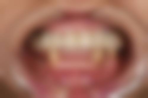 诊疗特色总结:个性化与舒适度并重