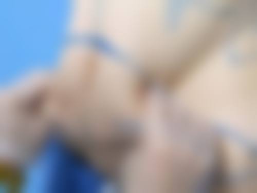 廖医生：懂美学更懂安心的注射骨干医生