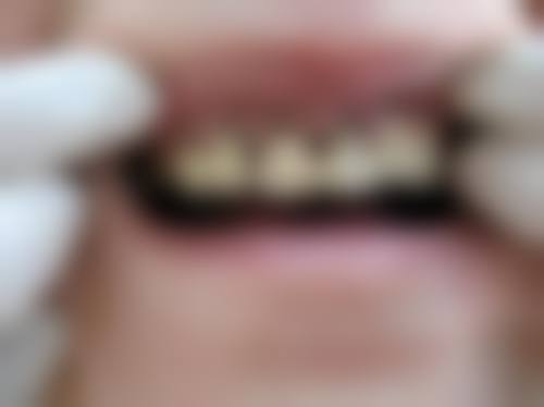 患者真实评价:成都瑞泰融诚口腔医院孙劲东