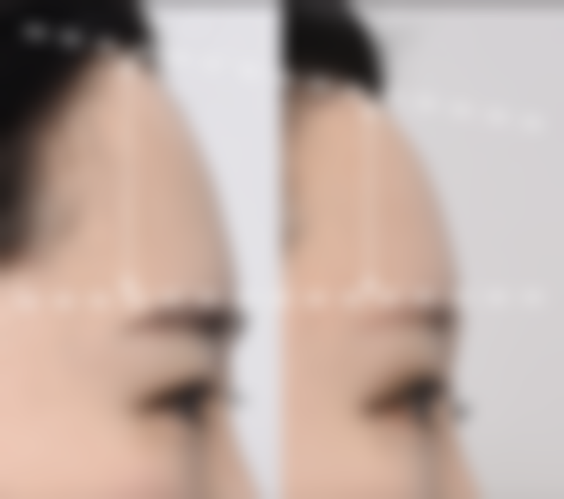 这家医院做Cellucare修复针到底靠谱吗？