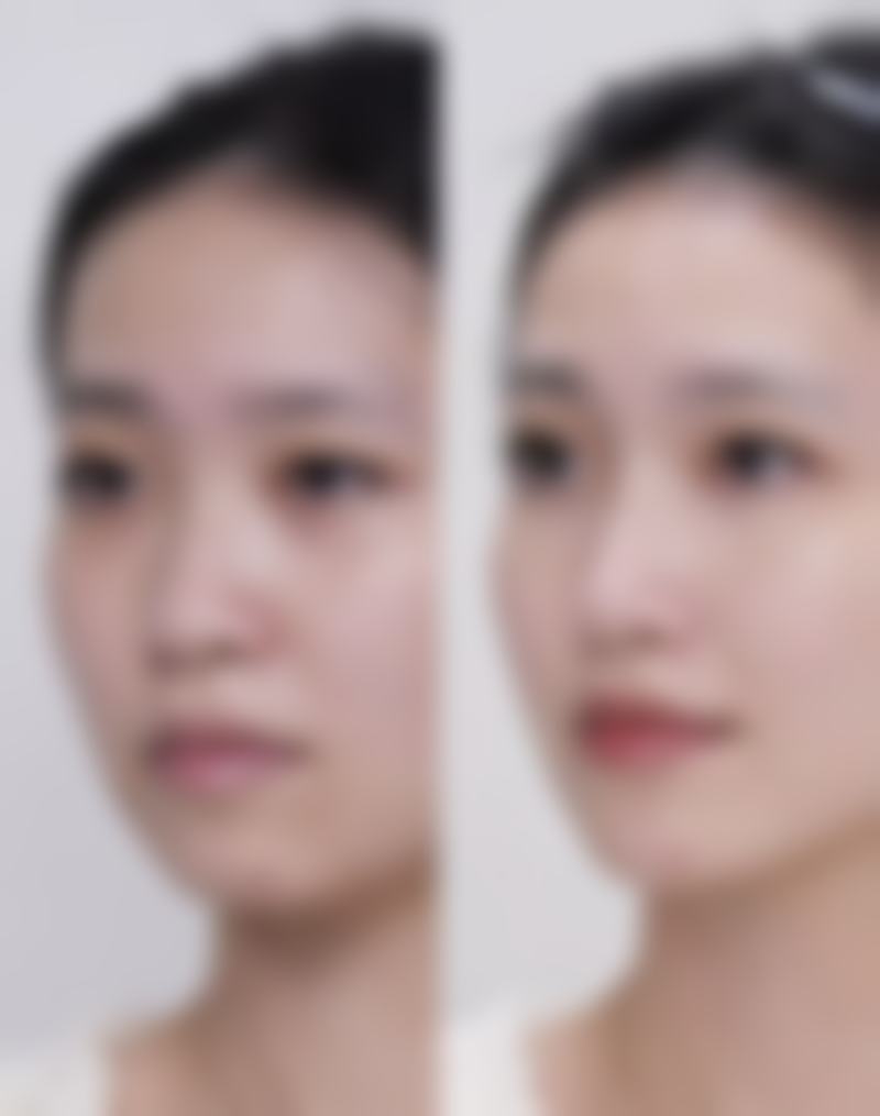昭通爱丽诺整形美容医院:预约挂号与交通指南