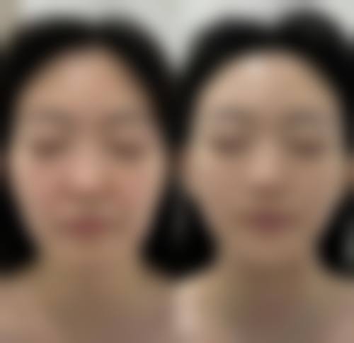 特色植发技术与项目优势
