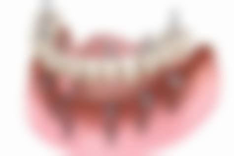 设备环境与优惠活动：透明收费打造亲民口碑