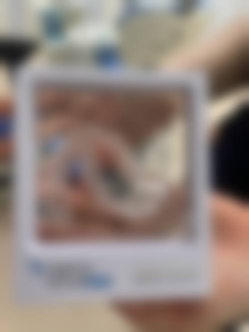 擅长项目详解