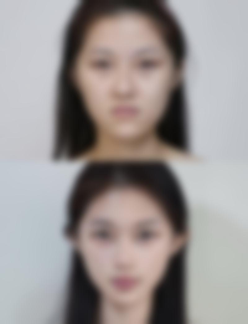 凯里雅典娜整形医院环境与就医指南