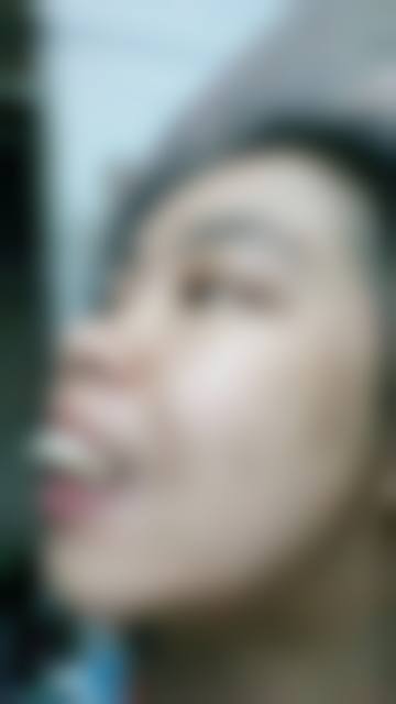患者真实评价杭州艾维春江花月口腔门诊部伍冰洁