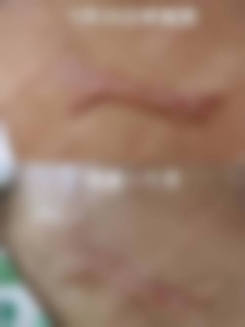 真实口碑好评:患者眼中的李学富医生