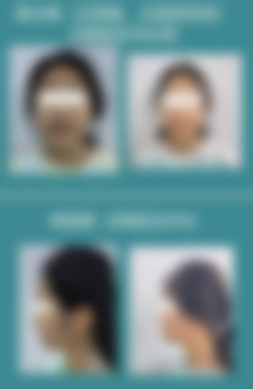 常见问题解答与总结