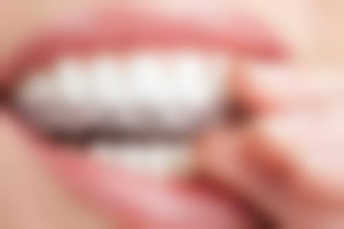 FAQ杭州艾维春江花月口腔门诊部伍冰洁