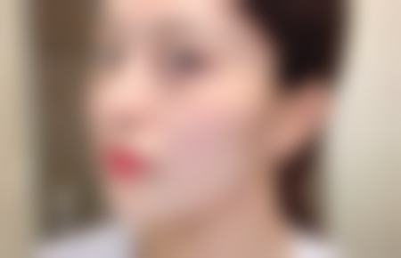 韩国波澜整形外科真实口碑与收费价格参考