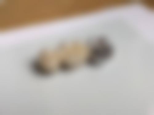 临床实例分享：找张桂云医生治疗能达到理想成效吗？