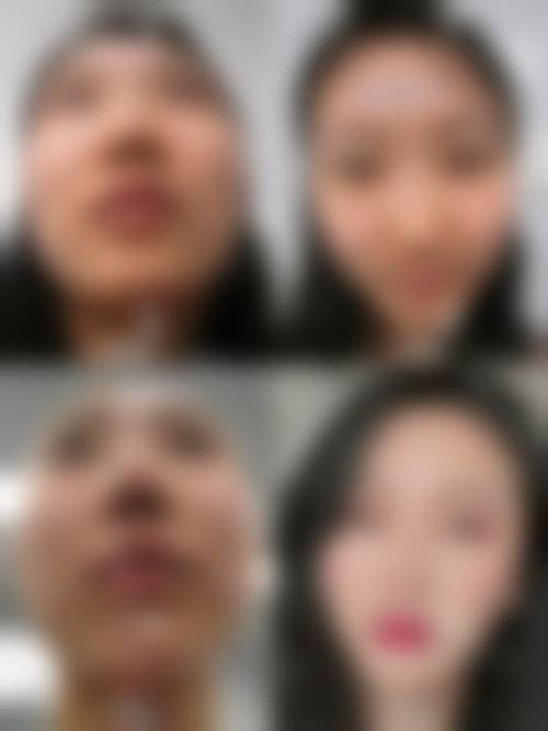 精良设备环境与层流手术室标准