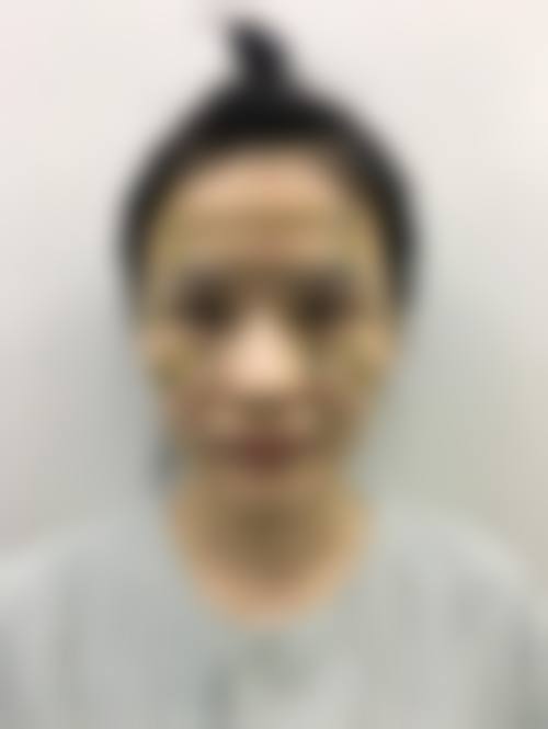 临床实例分享
