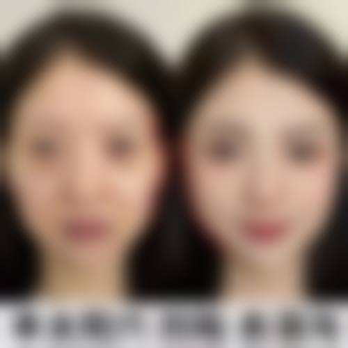 常见问题解答