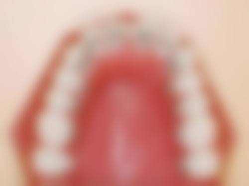 预约优惠活动：限时补贴助力家庭口腔健康