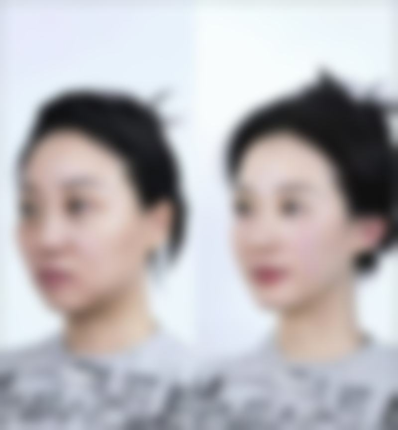 承德颜熙整形医院擅长项目与技术优势解析