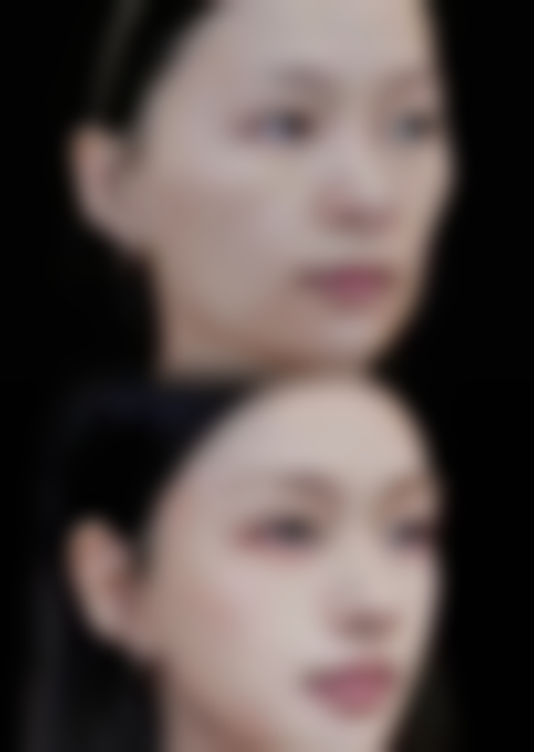 深圳睿恩医疗美容诊所常见问答(Q&A)