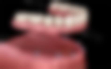 诊疗特色总结:上海永华口腔门诊部李登辉的技术优势