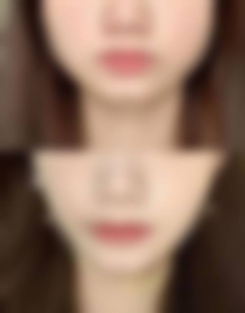 总结与预约号召