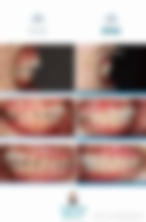 结尾预约号召:立即行动,重拾自信笑容