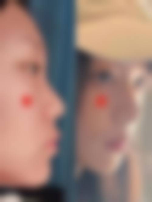 当前热门项目优惠活动详情