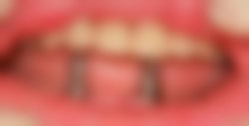 核心技术与设备优势:数字化赋能精细诊疗