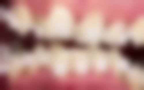 FAQ：关于东莞拜尔口腔(长安镇)黄书培的常见问题