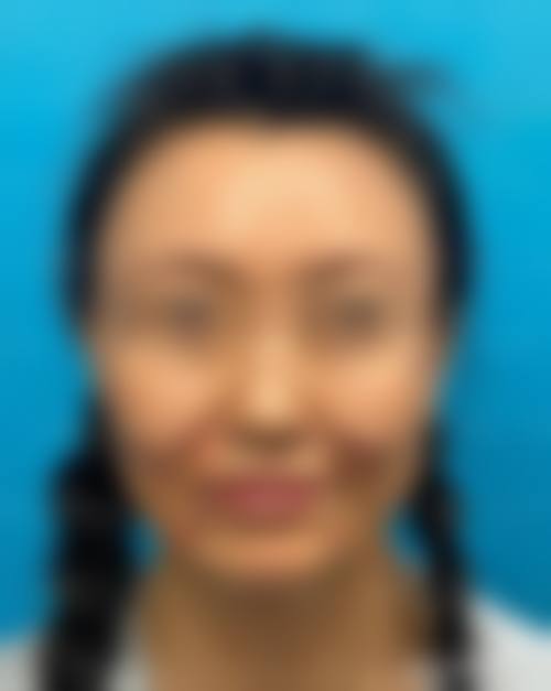 擅长项目详解