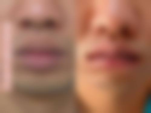 特色项目全方面解析,满足多样化变得更美需求