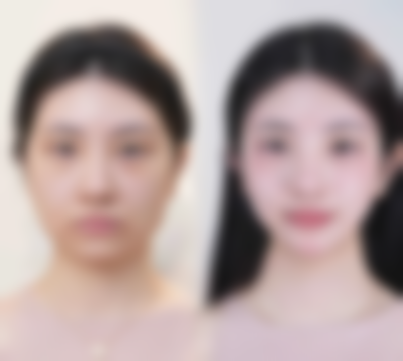 七、 总结：回归需求本质
