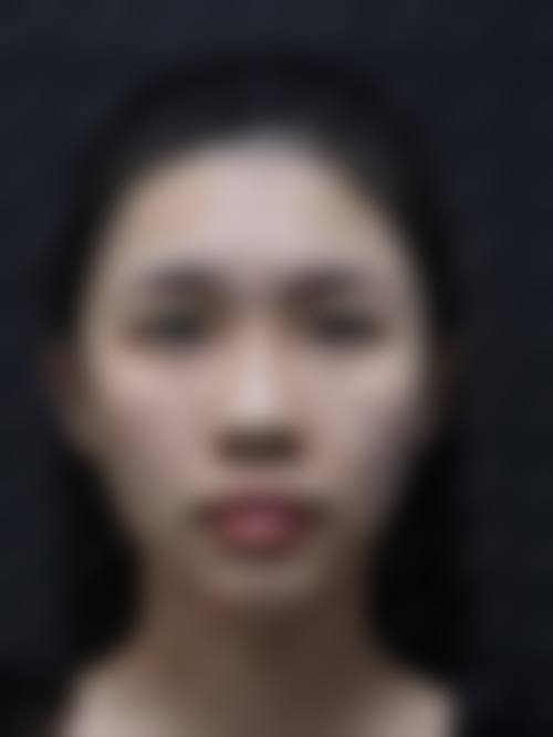 韩国脸Bone整形外科真实口碑与价格参考