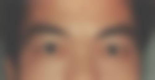 临床实例分享
